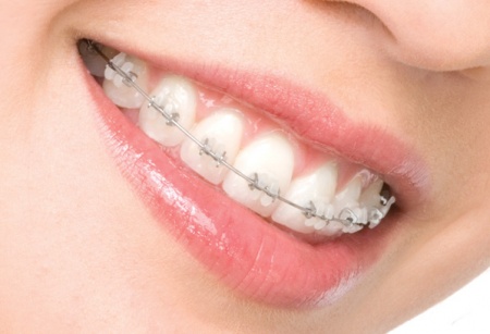 Изменение прикуса – процесс результативный в любом возрасте!», – утверждают врачи стоматологии на Позняках «Вива-Дент»